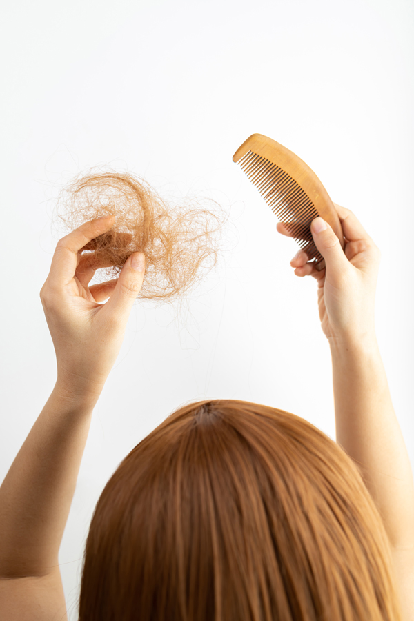 Tipos de alopecia